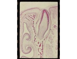 ENAMEL ORGAN (SECT) MAL (PIG FETUS)