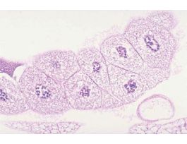 DROSOPHILA CHROMOSOMES (SECT) H&E SLIDE