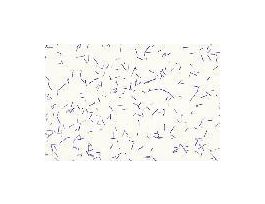 Clostridium botulism (SM) G(+)