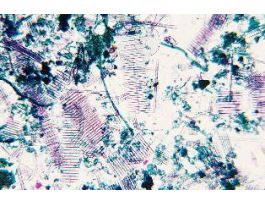 BASIC PROTIST SLIDE SET/6