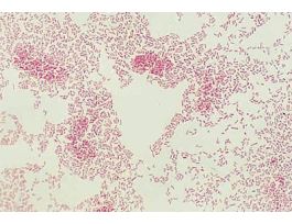 FD ESCHERICHIA COLI CULTURE GRAM -