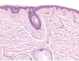 HUMAN SKIN COMPOSITE (SECT) H&E