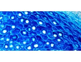 PERMABLUE PLUS/AP, CHROMOGEN 110ML