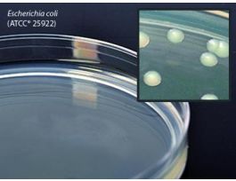 MEDIUM STD METHOD AGR 15X100MM PLTD PK10