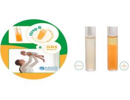 STREP B CARROT BR ONESTEP 16X100MM 6ML