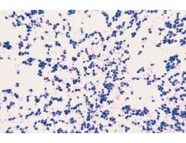CANDIDA ALBICANS(SM)CHLAMYDOSPORE STAGE