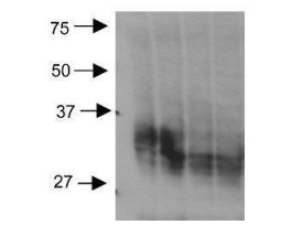 AQUAPORIN 3 ANTIBODY 100UL