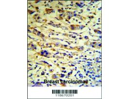 A1BG ANTIBODY (C-TERM)