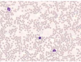 CAT OR RABBIT BLOOD SMEAR