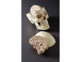 MODEL SKULL WITH WARDS BRAIN.