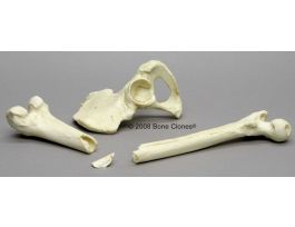 BLUNT FORCE TRAUMA POSTCRANIALS