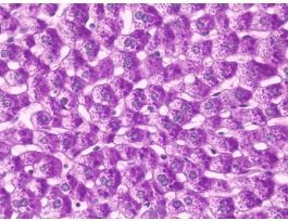 GLYCOGEN LIVER PAS & H W/STUDY GUIDE