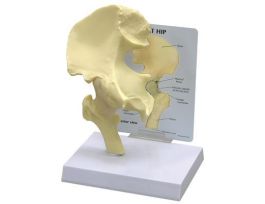 MODEL HIP JOINT