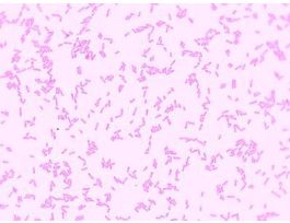 E.COLI (SM) G(-) FOUND IN HUMAN