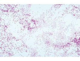 FD SALMONELLA ENTERITIDIS W/MEDIA