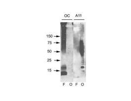 AMYLOID ANTIBODY 100UL