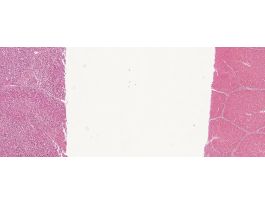 AUTOLYSIS OF LIVER (SEC) H&E