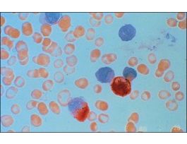Naphthol AS-D Chloroacetate (Specific Esterase) Kit