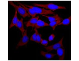 Monoclonal Anti-Actin (alpha-Sarcomeric) antibody produced in mouseclone 5C5, ascites fluid 100UL