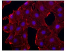 Monoclonal Anti-beta-Actin antibody produced in mouseclone AC-74, purified immunoglobulin, buffered aqueous solution 100UL