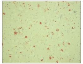 Monoclonal Anti-beta-Amyloid antibody produced in mouseclone BAM-10, purified from hybridoma cell culture 200UL