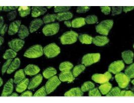 Monoclonal Anti-Actin antibody produced in mouseclone AC-40, ascites fluid .2ML