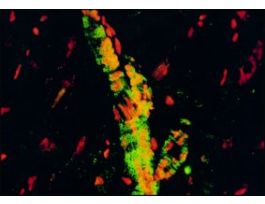 Monoclonal Anti-alpha-Actinin antibody produced in mouseclone BM-75.2, ascites fluid .2ML