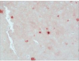 Monoclonal Anti-beta-Amyloid antibody produced in mouseclone BAM-10, ascites fluid