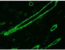 Anti-Actin, alpha-Smooth Muscle antibody, Mouse monoclonalclone 1A4, purified from hybridoma cell culture 200UL