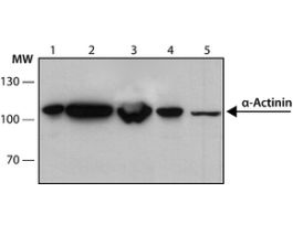 Anti-alpha-Actinin (Sarcomeric) antibody, Mouse monoclonalclone EA-53, purified from hybridoma cell culture 200UL