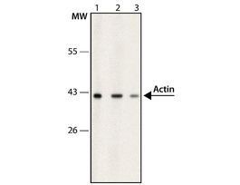 Anti-Actin, Cardiac antibody, Mouse monoclonalclone AC1-20.4.2, purified from hybridoma cell culture 200UL