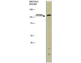Anti-Androgen Receptor antibody produced in rabbitaffinity isolated antibody, buffered aqueous solution
