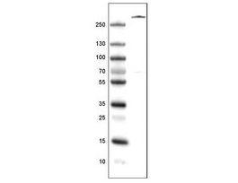 Monoclonal Anti-VWF antibody produced in mousePrestige Antibodies(R) Powered by Atlas Antibodies, clone CL1957, purified immunoglobulin, buffered aqueous glycerol solution