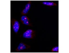 Monoclonal Anti-B23 antibody produced in mouseclone FC82291, purified immunoglobulin, buffered aqueous solution 100UL