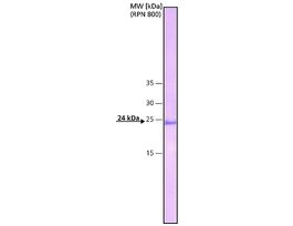 Monoclonal Anti-C-Reactive Protein antibody produced in mouseclone CRP-8, ascites fluid .2ML