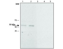 Anti-Calsequestrin-2 antibody produced in rabbit~1.0 mg/mL, affinity isolated antibody, buffered aqueous solution