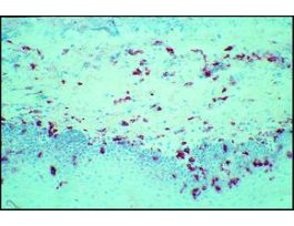 Monoclonal Anti-CD14 antibody produced in mouseclone UCHM-1, purified immunoglobulin, buffered aqueous solution