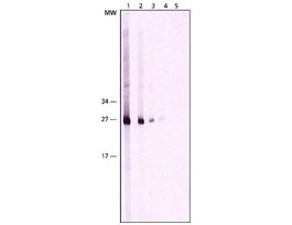 Monoclonal Anti-Cathepsin K antibody produced in mouse~2 mg/mL, clone CL124-1H6, purified immunoglobulin, buffered aqueous solution 200UL