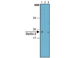 Anti-Derlin-2 antibody produced in rabbit~1.0 mg/mL, affinity isolated antibody, buffered aqueous solution