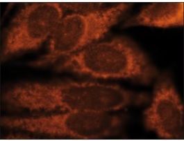 Anti-Derlin-3 antibody produced in rabbit~1 mg/mL, affinity isolated antibody, buffered aqueous solution
