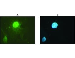 Anti-DNMT1 antibody produced in rabbitIgG fraction of antiserum, buffered aqueous solution