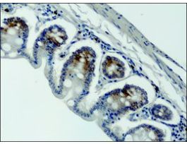 Anti-DSCR1 (C-terminal) antibody produced in rabbit~1.5 mg/mL, affinity isolated antibody, buffered aqueous solution
