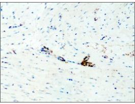 Anti-Destrin/ADF (GV-13) antibody produced in rabbitaffinity isolated antibody, buffered aqueous solution