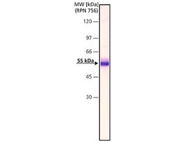 Monoclonal Anti-Factor IX antibody produced in mouseclone HIX-5, purified immunoglobulin, buffered aqueous solution