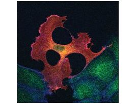 Monoclonal ANTI-FLAG(R) M2 antibody produced in mouse1 mg/mL, clone M2, affinity isolated antibody, buffered aqueous solution 200UG
