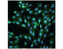 Anti-von Willebrand Factor antibody produced in rabbitIgG fraction of antiserum, buffered aqueous solution 100UL