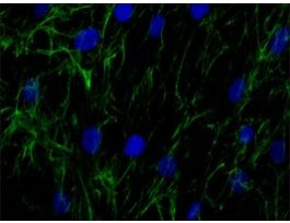 Anti-Fibronectin antibody produced in rabbitaffinity isolated antibody, buffered aqueous solution .5ML
