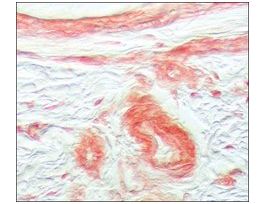 Anti-Fibroblast Growth Factor Receptor-1 antibody produced in rabbit~1 mg/mL, affinity isolated antibody, buffered aqueous solution