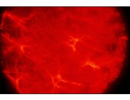 Monoclonal Anti-Glial Fibrillary Acidic Protein (GFAP) antibody produced in mouseclone G-A-5, ascites fluid 100UL