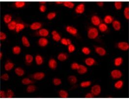 Anti-Histone Deacetylase 2 (HDAC2) antibody, Mouse monoclonalclone HDAC2-62, purified from hybridoma cell culture 100UL